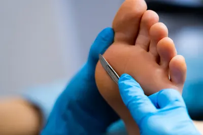 Opolskie Centrum Podologii - PODOLOGIA I CHIRURGIA